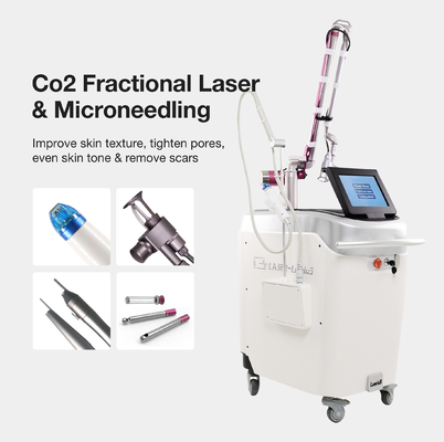 Co2-Laser die NdYag-Laser Witte Kleur weer opduiken